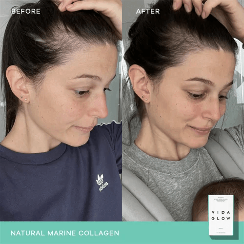 Vida Glow Natural Marine Collagen 30 x 3g sachets - Original, image 5