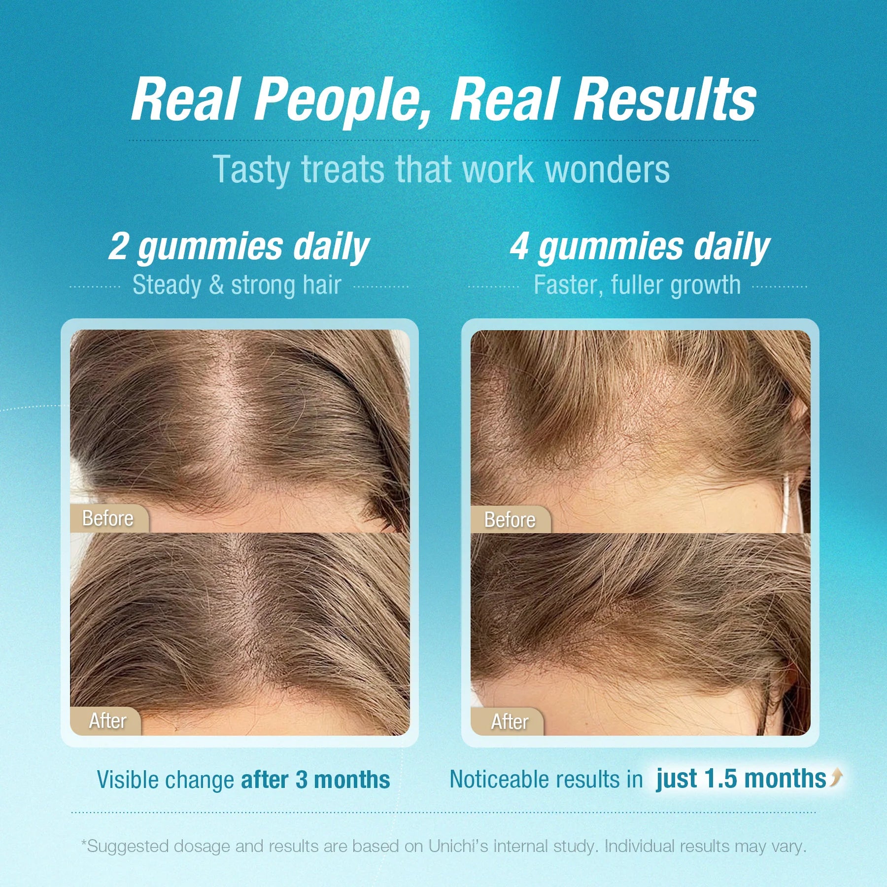 Advertisement for hair growth gummies showing before and after hairline images with text about dosages and results.